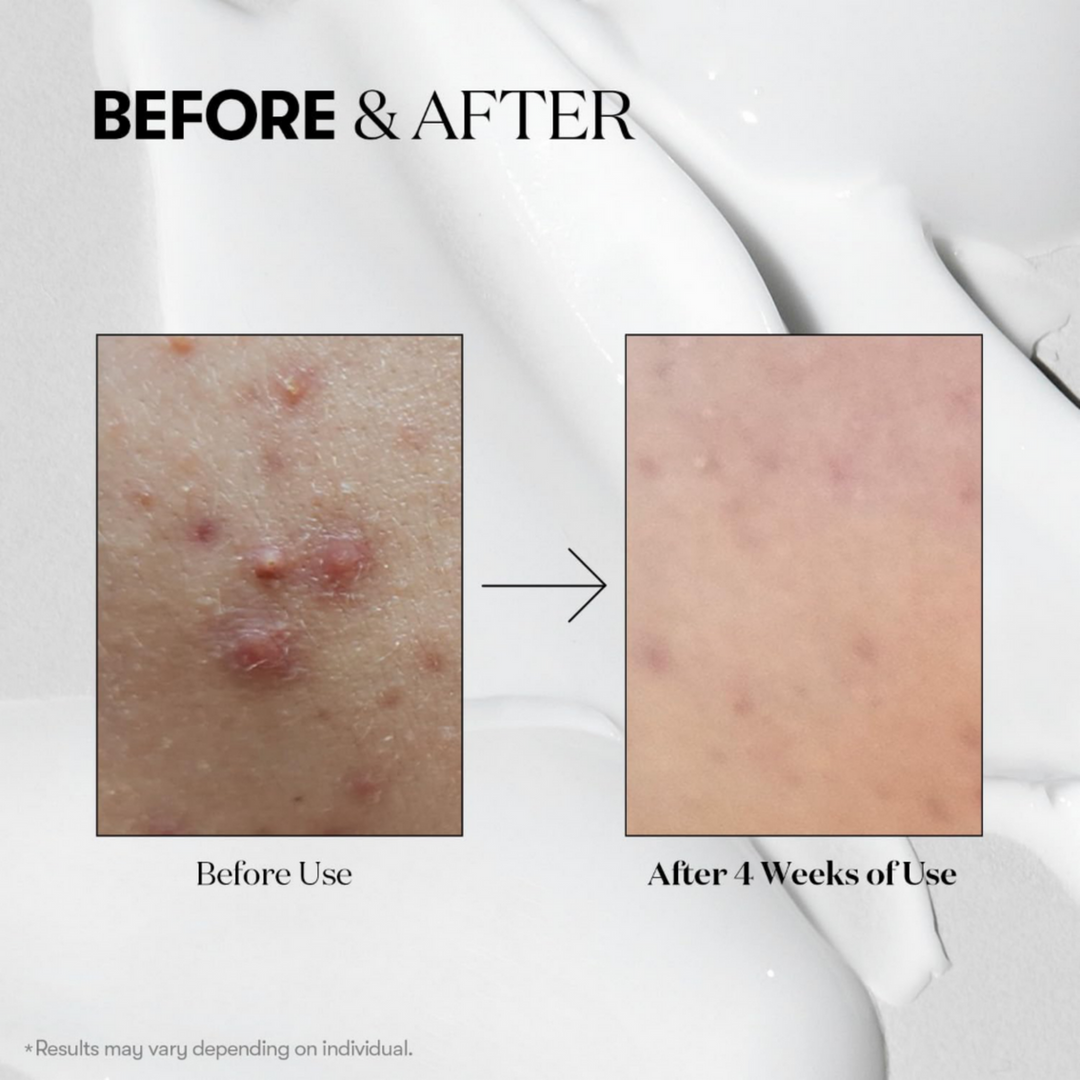 VT - Mild Reedle Shot 50 - 50ml by VT Cosmetics